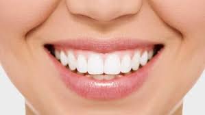 How Much Does Tooth Bonding Cost?