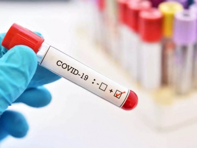 Covid-19 pandemic a result of lab leak: US agency
