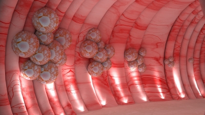 Colorectal cancer: Gurugram hospital exhibits a 3D walkthrough colon