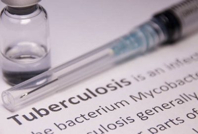 Tuberculosis remains key cause of ill health, death in South Africa
