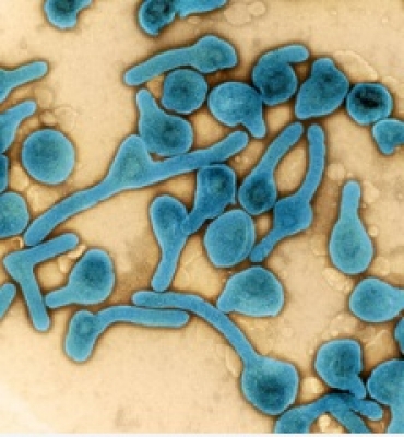 Child dies of Marburg virus disease in Tanzania, takes death toll to 6
