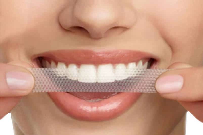 Should I Brush My Teeth Before Using Whitening Strips?