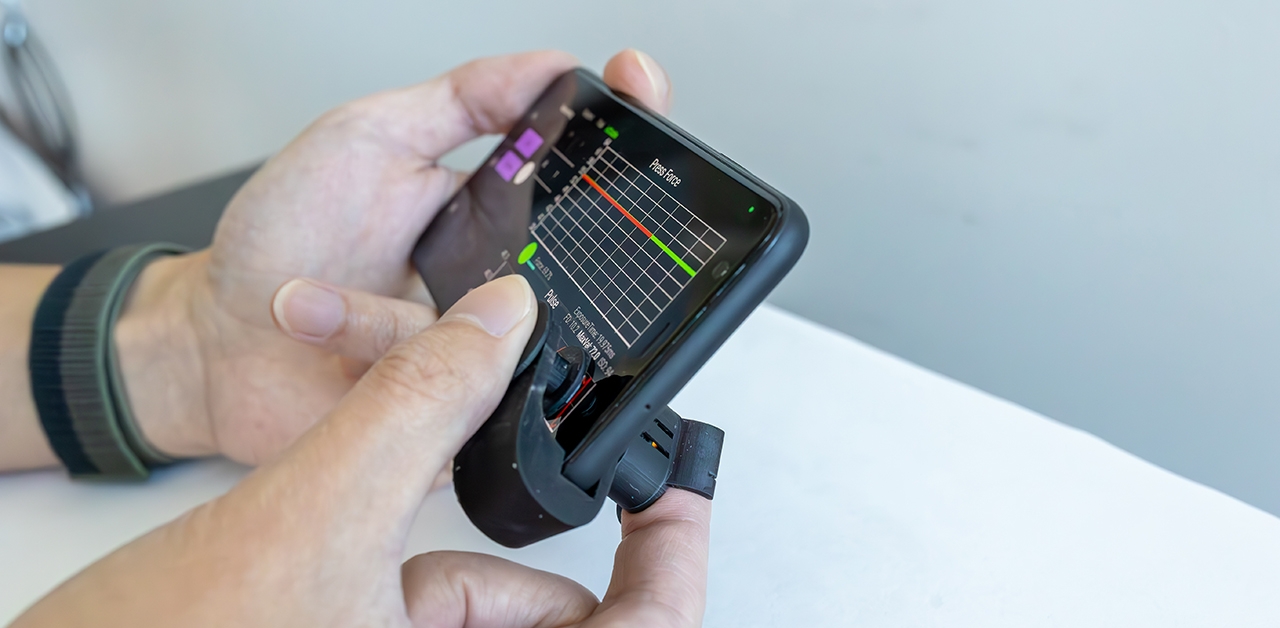 New low-cost clip can monitor BP using your smartphone’s camera